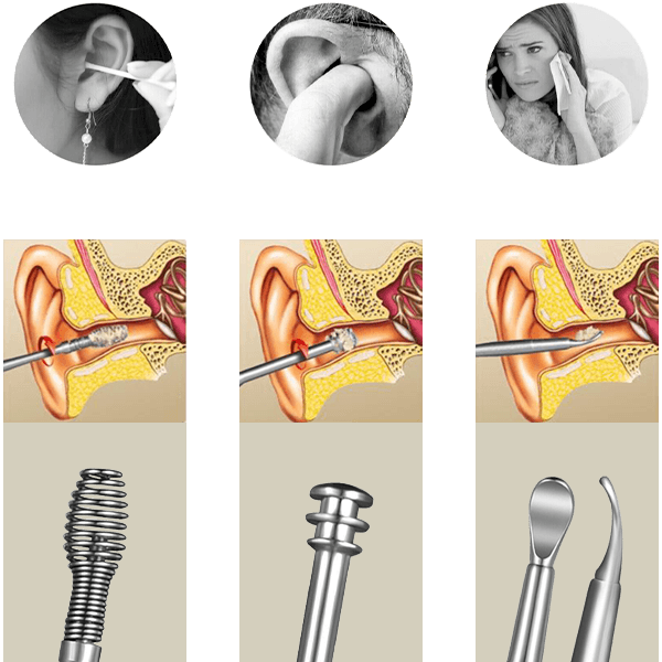Sada na čištění uší 03